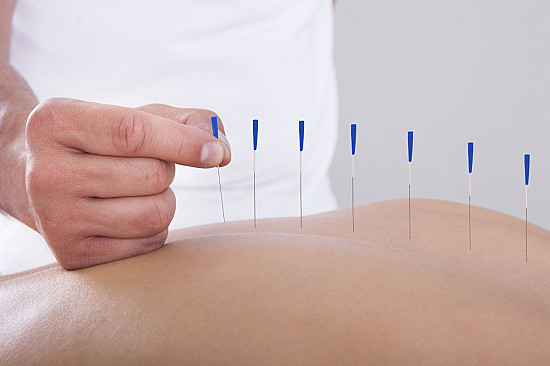Dr Chen performing acupuncture treatment
